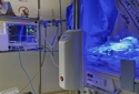 Чернівецькому обласному перинатальному центру передали дороговартісне медичне обладнання для підтримки життєдіяльності новонароджених